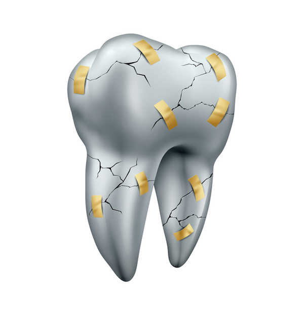 Tooth Repair