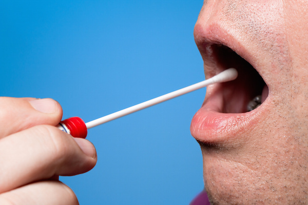 Liquid biopsy cancer test closer; dental offices ideal for screening