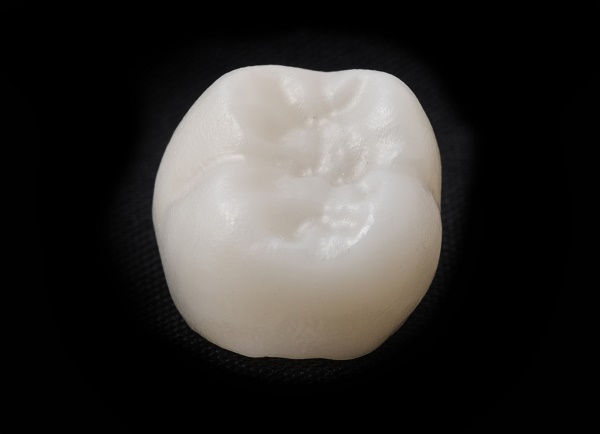 filling cavities