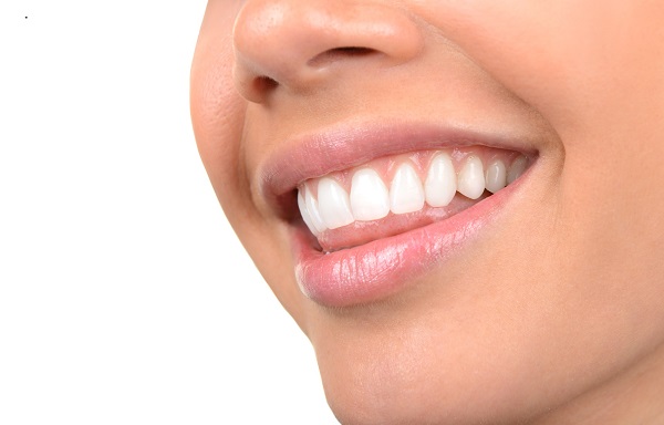 Everything You Need to Know About Veneers Technology