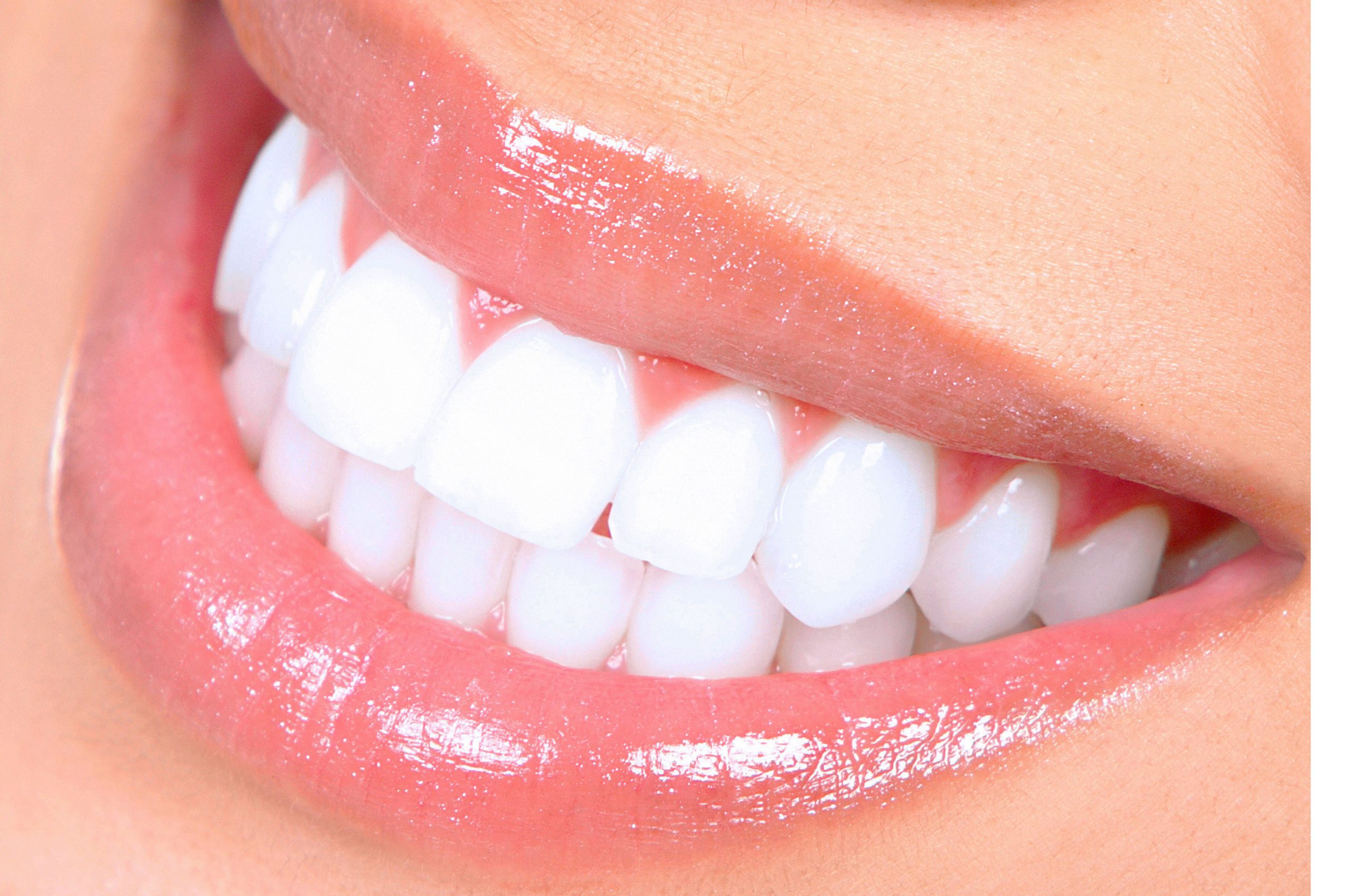 The Best Reasons to Get Your Teeth Whitened