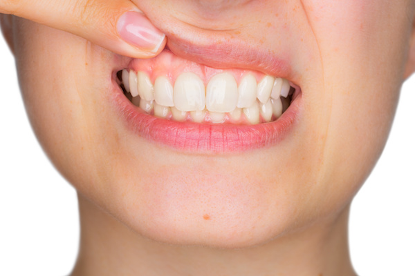 Important Guide to Gum Health