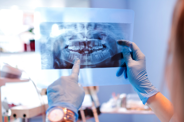 The Evolution of Dental X-Rays