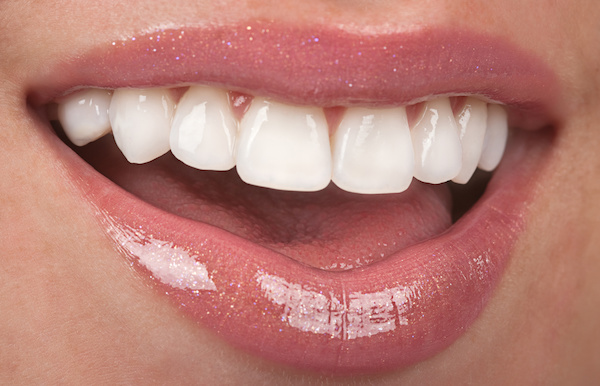 When to Choose Amalgam vs. Composite Resin