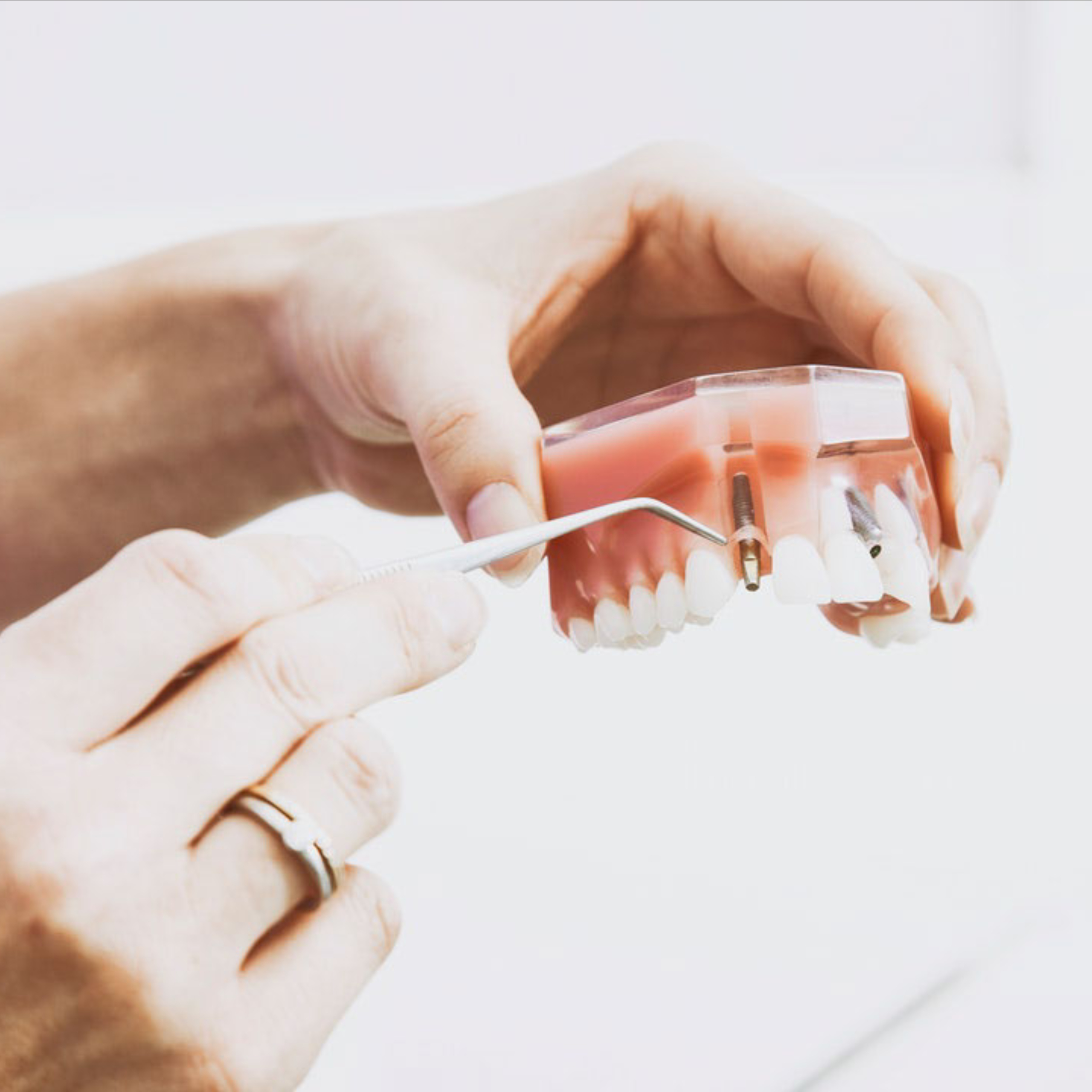 how long does it take for a cavity to form