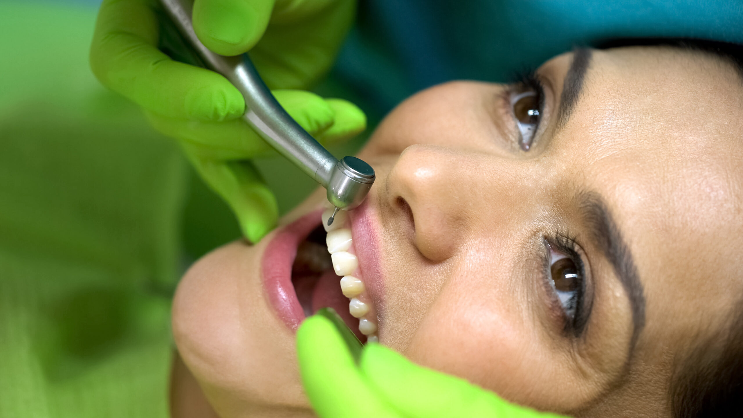Cracked Chipped Teeth Dental Work
