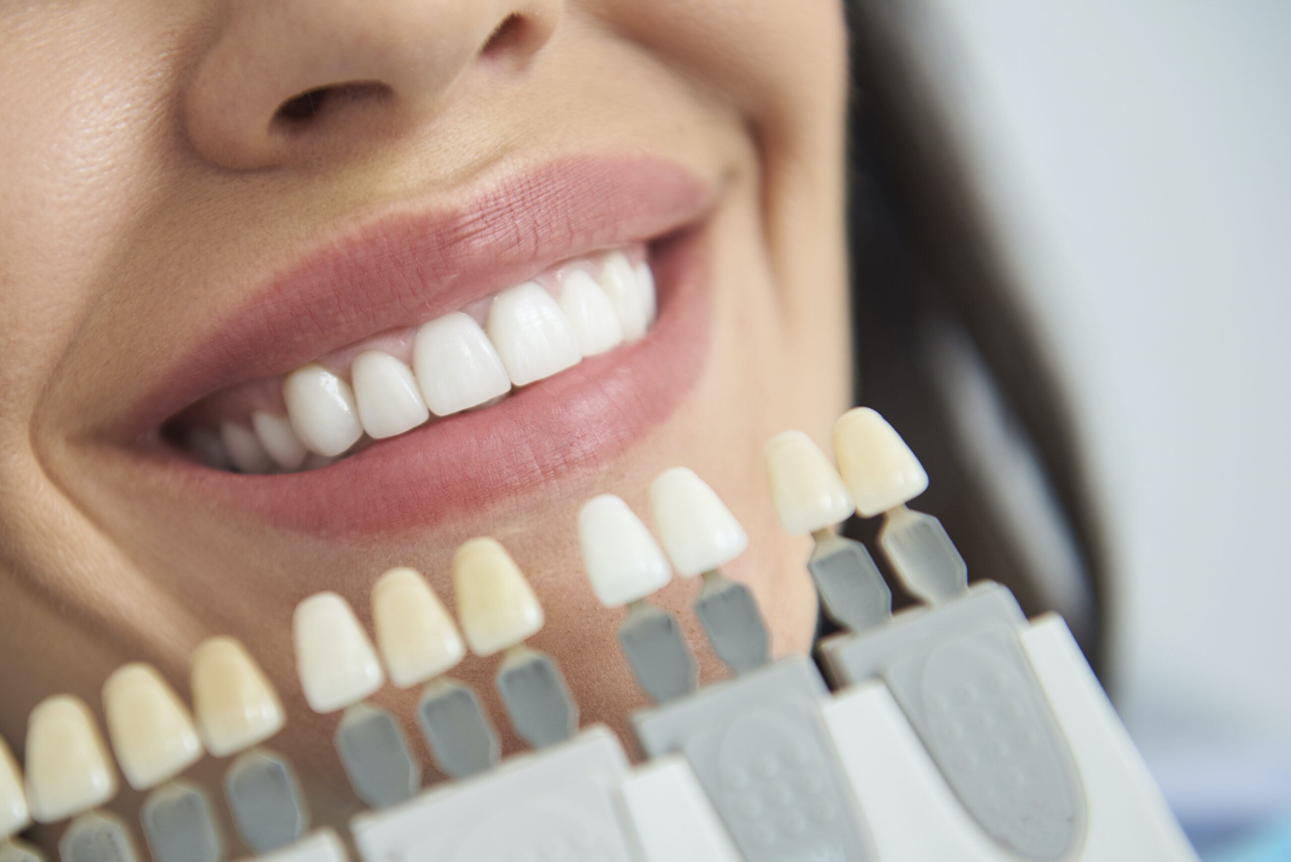 Want a Whiter Smile?