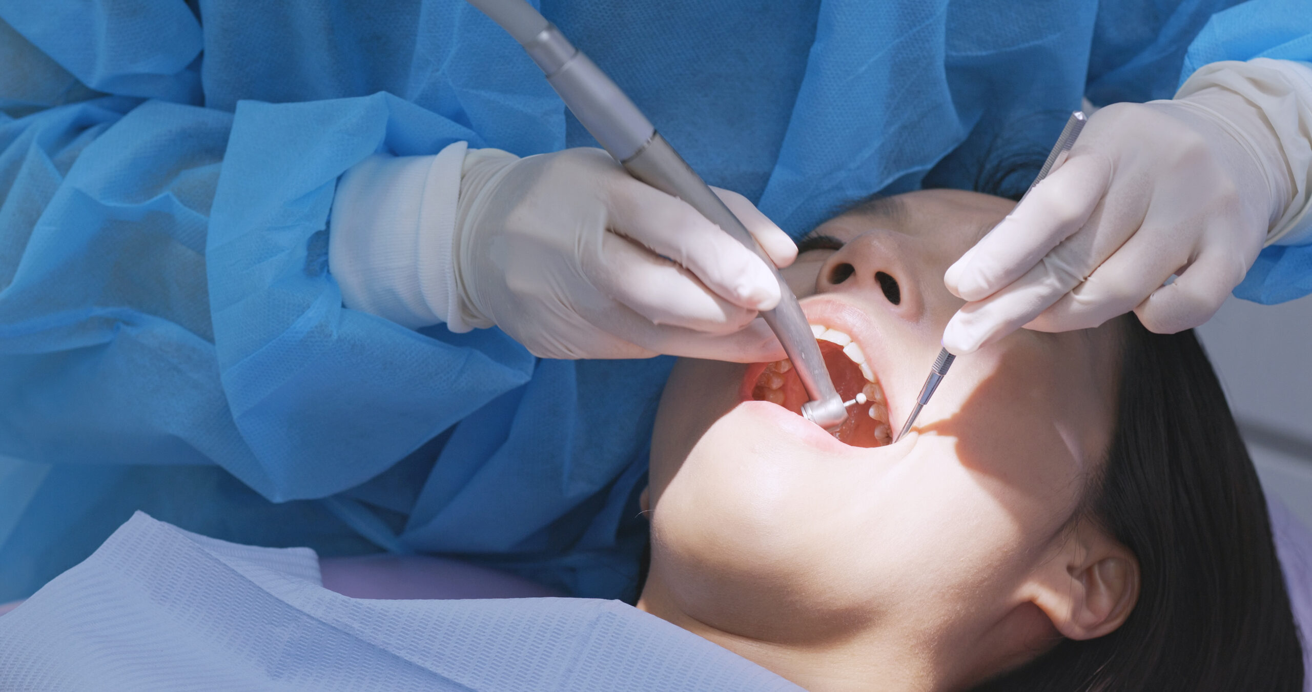 Common Reasons For Tooth Extraction or Removal