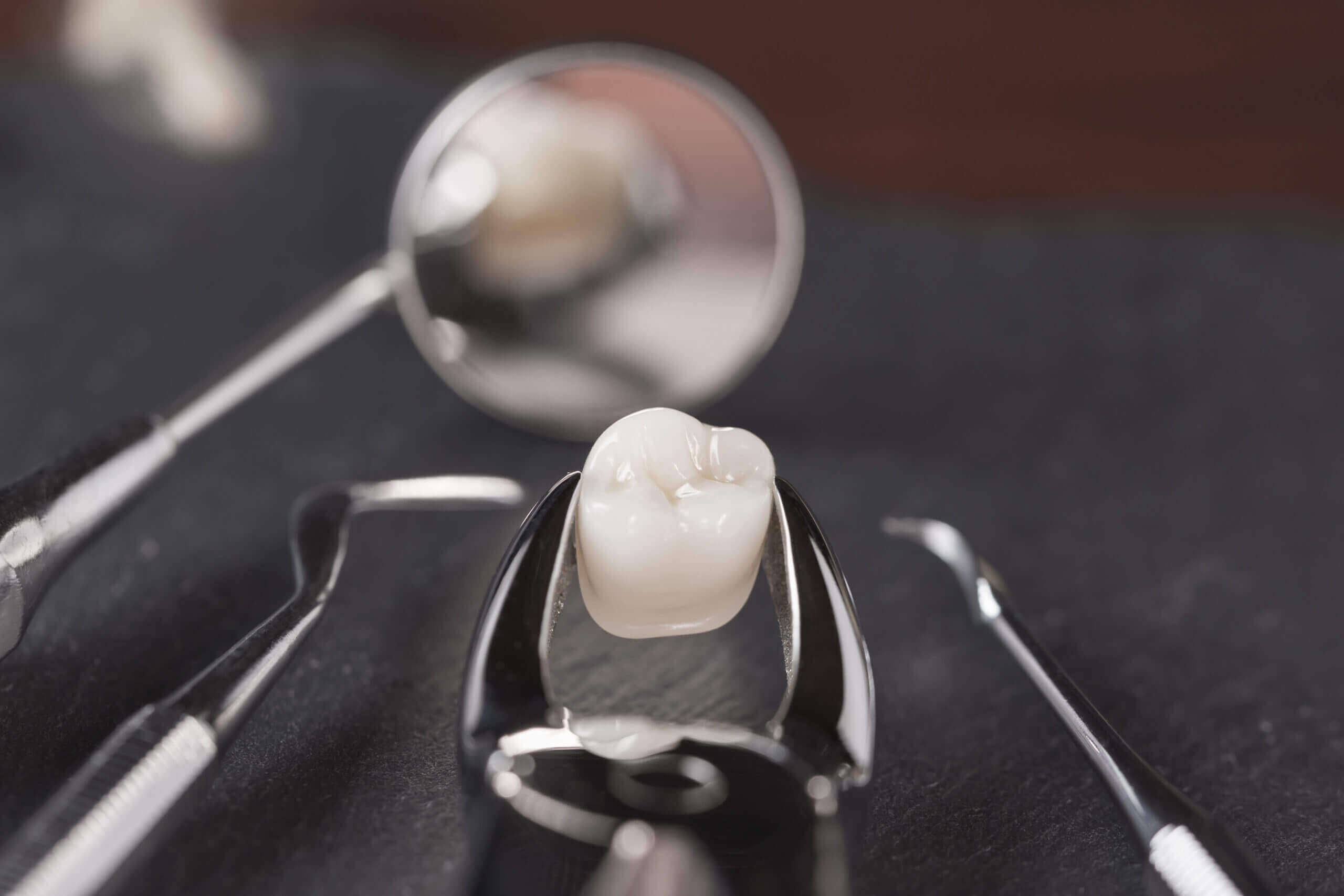tooth removed