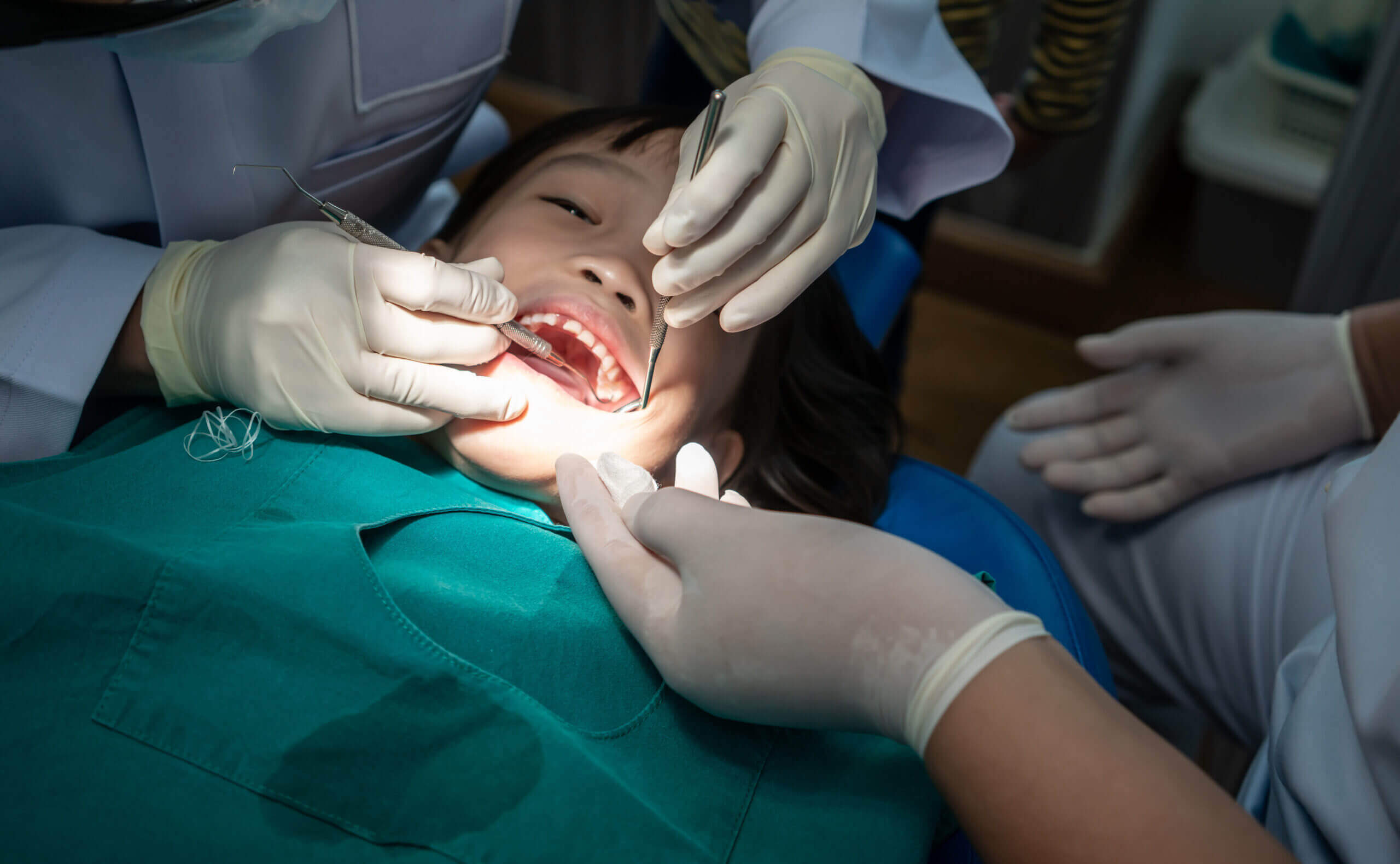 dental sealants