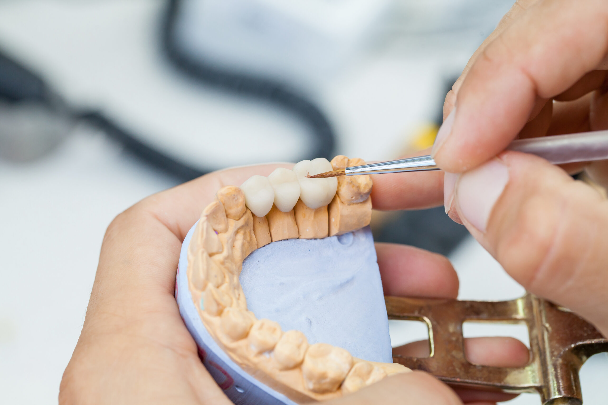 Crowns dental bridges smile teeth oral
