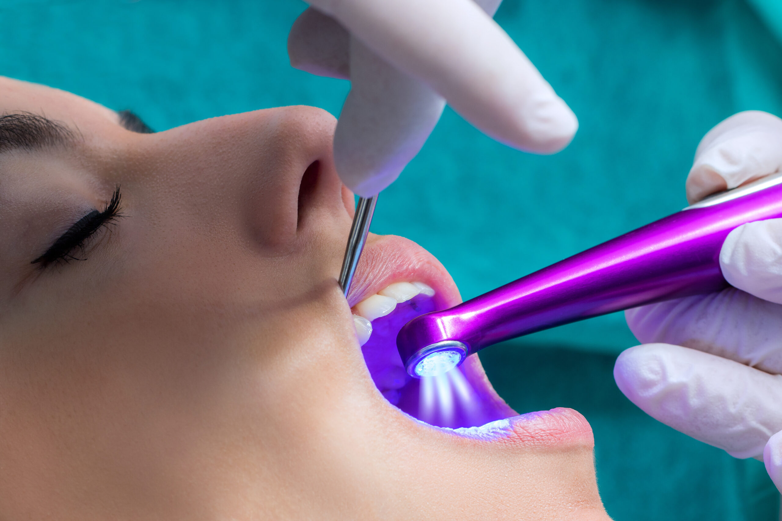 Dental decay care