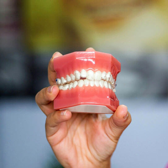 How Should I Choose Between Invisalign and Braces?