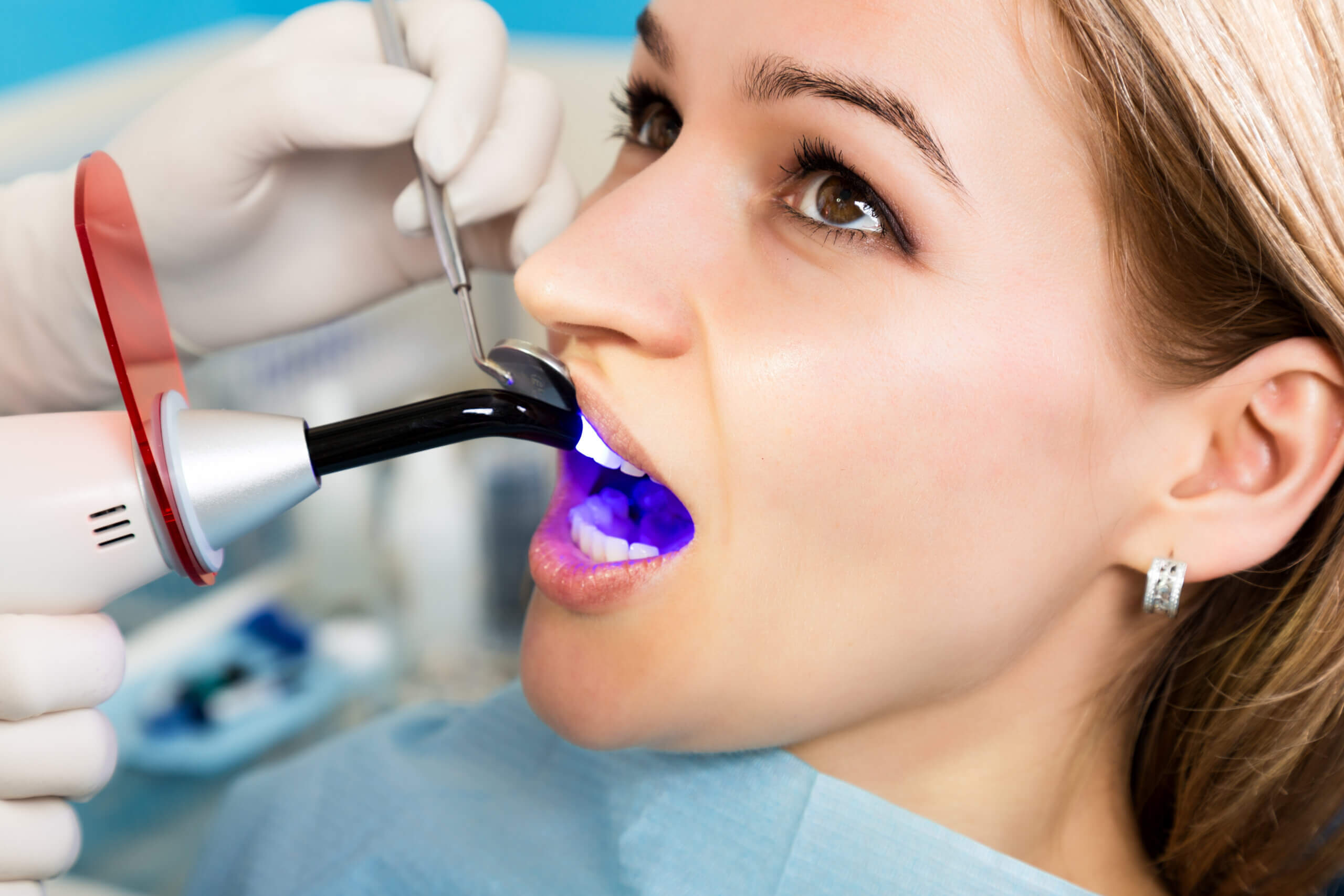 Types of Dental Fillings: Choosing the Best Option for Your Cavity