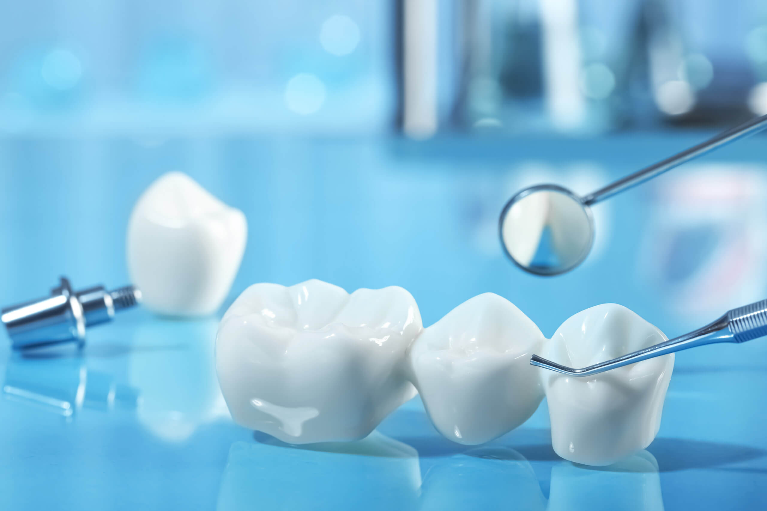 The Lifespan of Dental Crowns: How Long Can You Expect Them to Last?