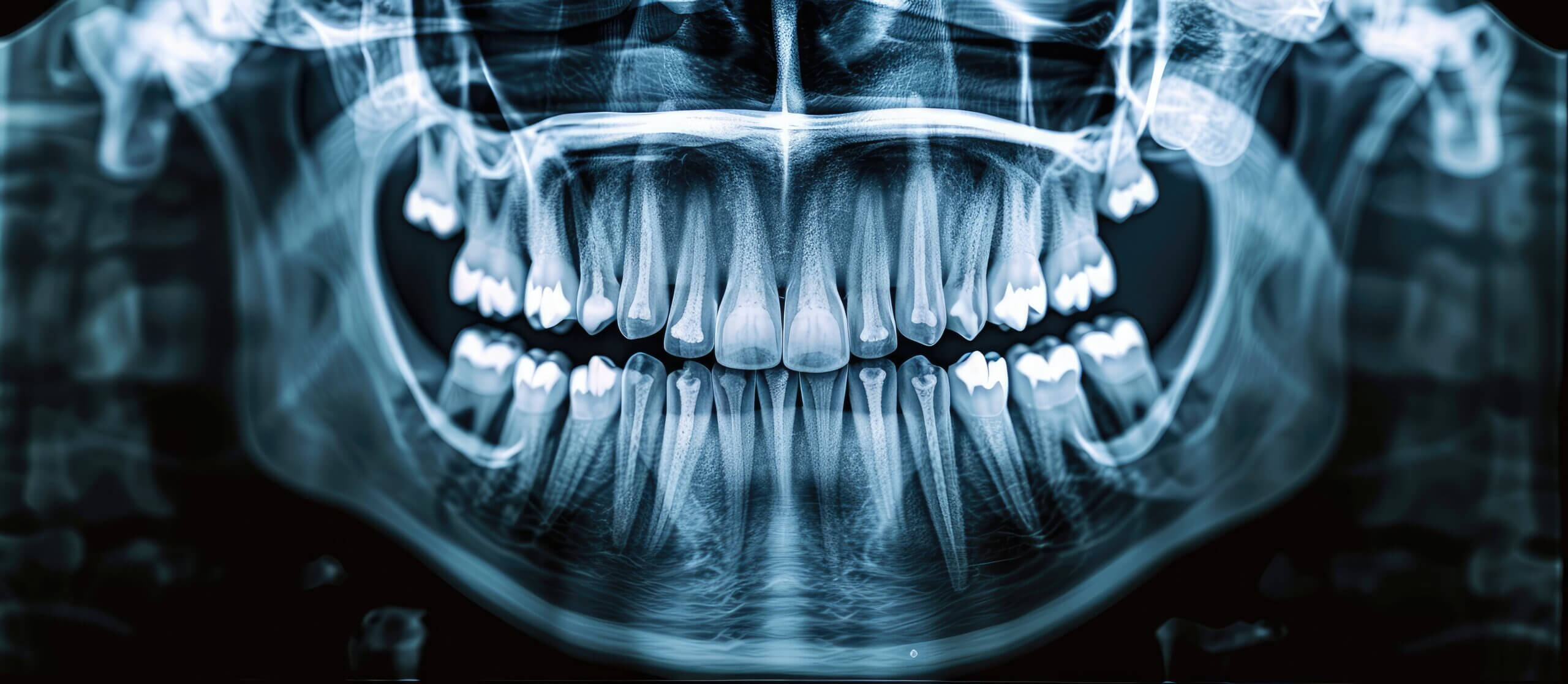 The X-Ray Report: Understanding Your Dental Imaging