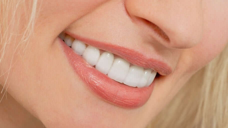 Lumineers cosmetic dentist Melbourne