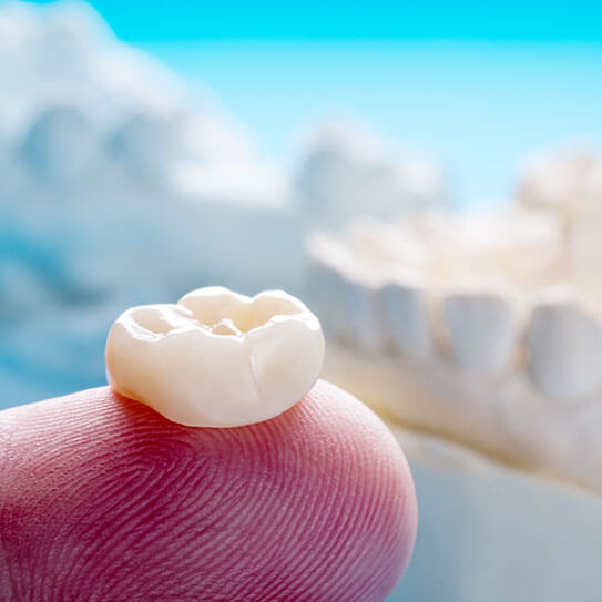 dental crowns Melbourne