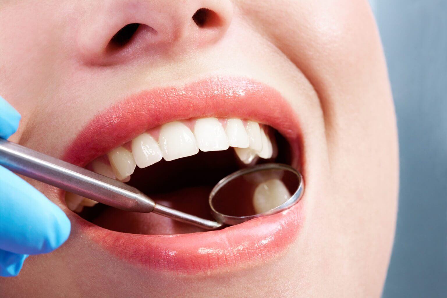 Away With Amalgam