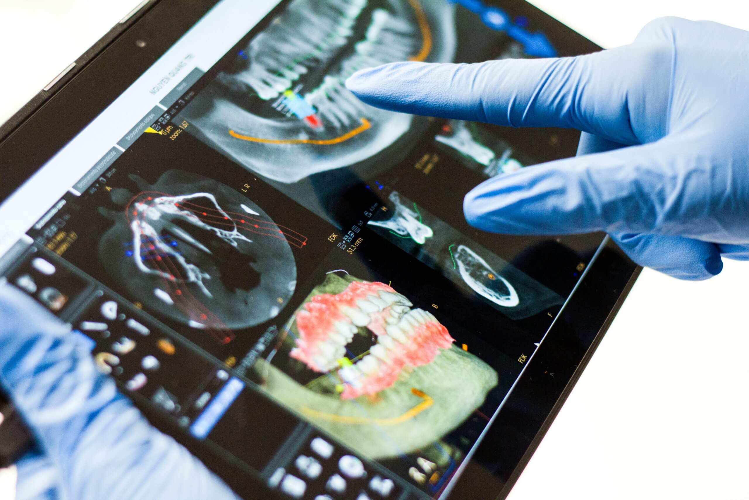 A Oral Cancer Screening Guide