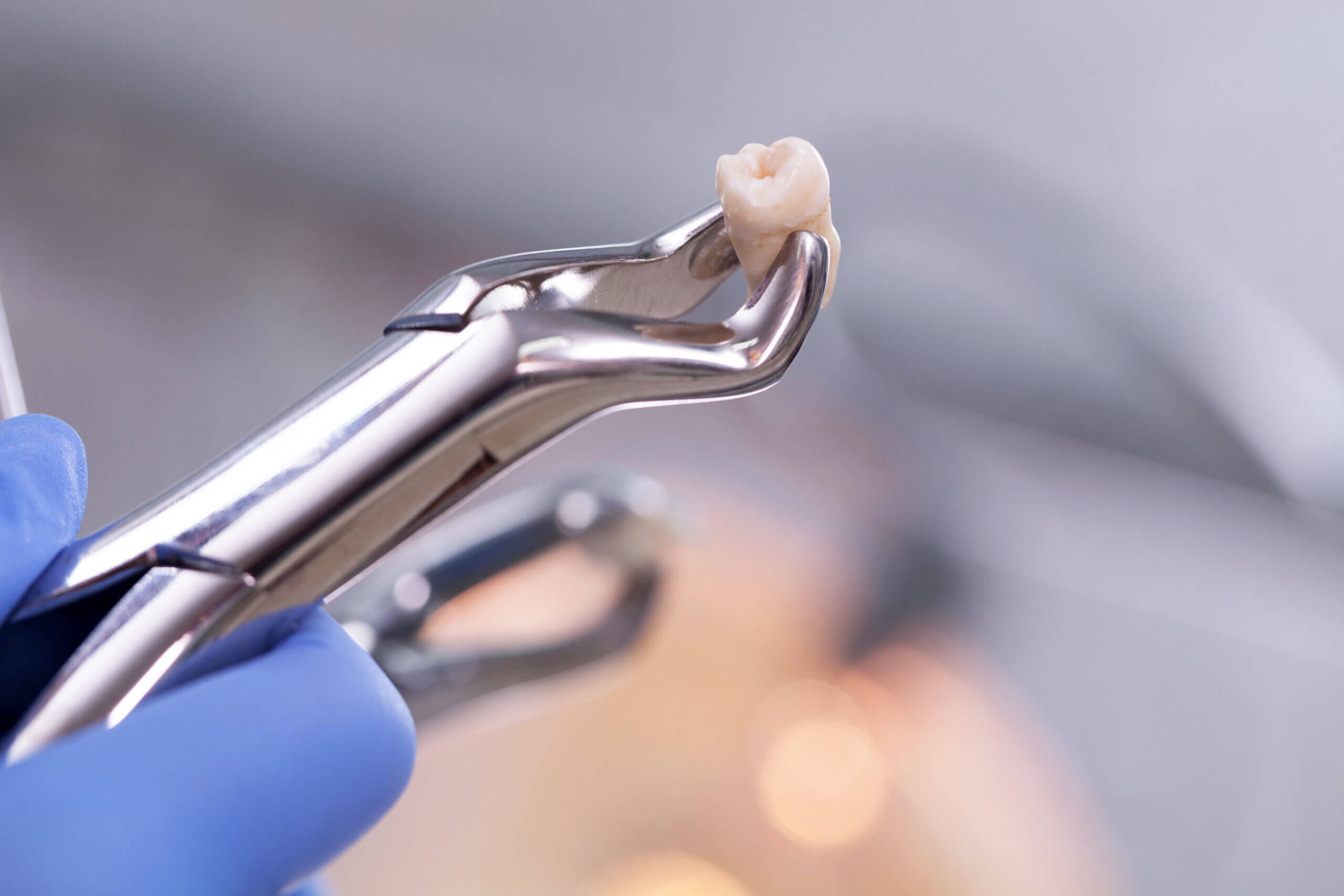 What to Know Before Looking for Extractions Near Me