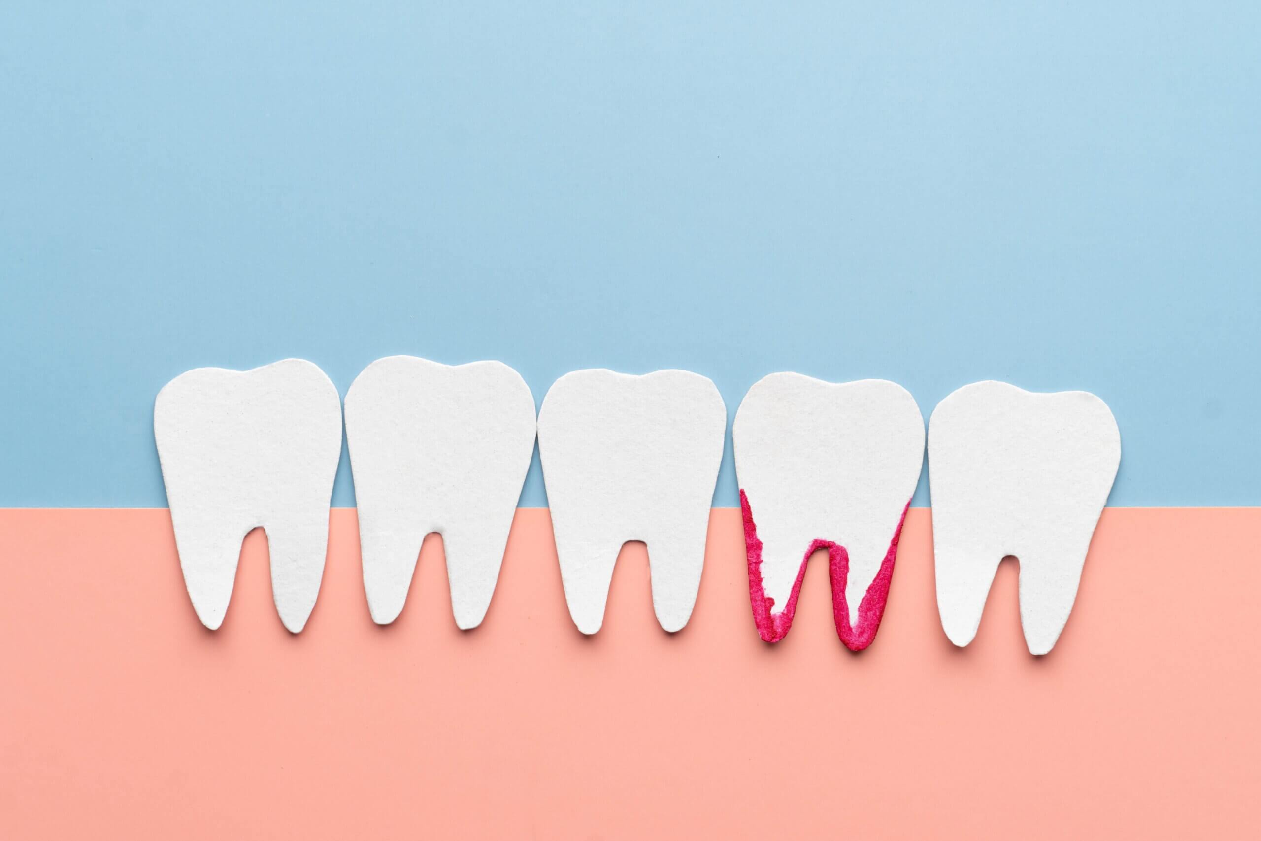 Why Your Gums Bleed When You Brush