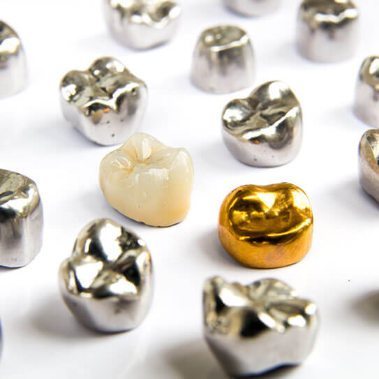 The Dental Crowns West Melbourne Trusts for Tooth Restoration