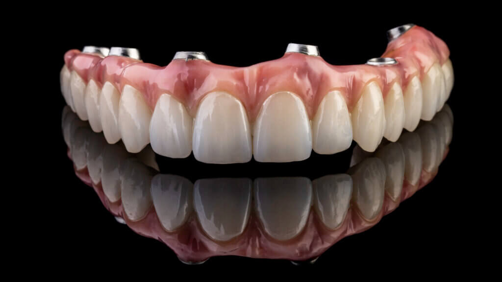 all-on-six hybrid prosthesis dentist West Melbourne